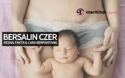 Bersalin Czer – Cara Berpantang, Kesan Selepas Bersalin, Fakta Luka Czer