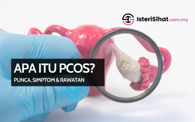 Apa Itu PCOS – Punca, Simptom Dan Rawatan