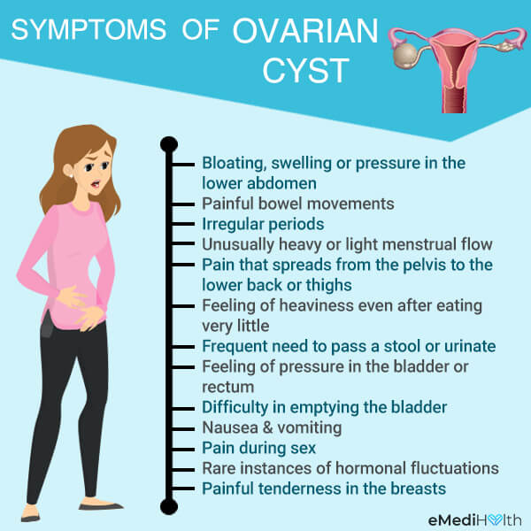 pin-on-do-ovarian-cysts-cause-back-pain